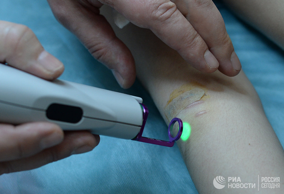 Лечение рубца лазером на красителях Лечение рубца лазером на красителях
