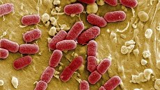 Энтерогеморрагическая бактерия Escherichia coli (EHEC) под микроскопом Энтерогеморрагическая бактерия Escherichia coli (EHEC) под микроскопом