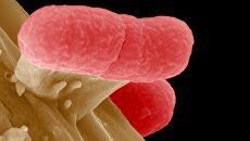 Энтерогеморрагическая бактерия Escherichia coli (EHEC) под микроскопом Энтерогеморрагическая бактерия Escherichia coli (EHEC) под микроскопом